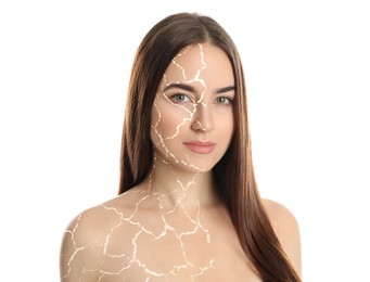 Collage with photos of woman having dry skin problem before and after dry skin problem on white background