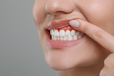 Image of Woman showing inflamed gum on grey background, closeup. Space for text