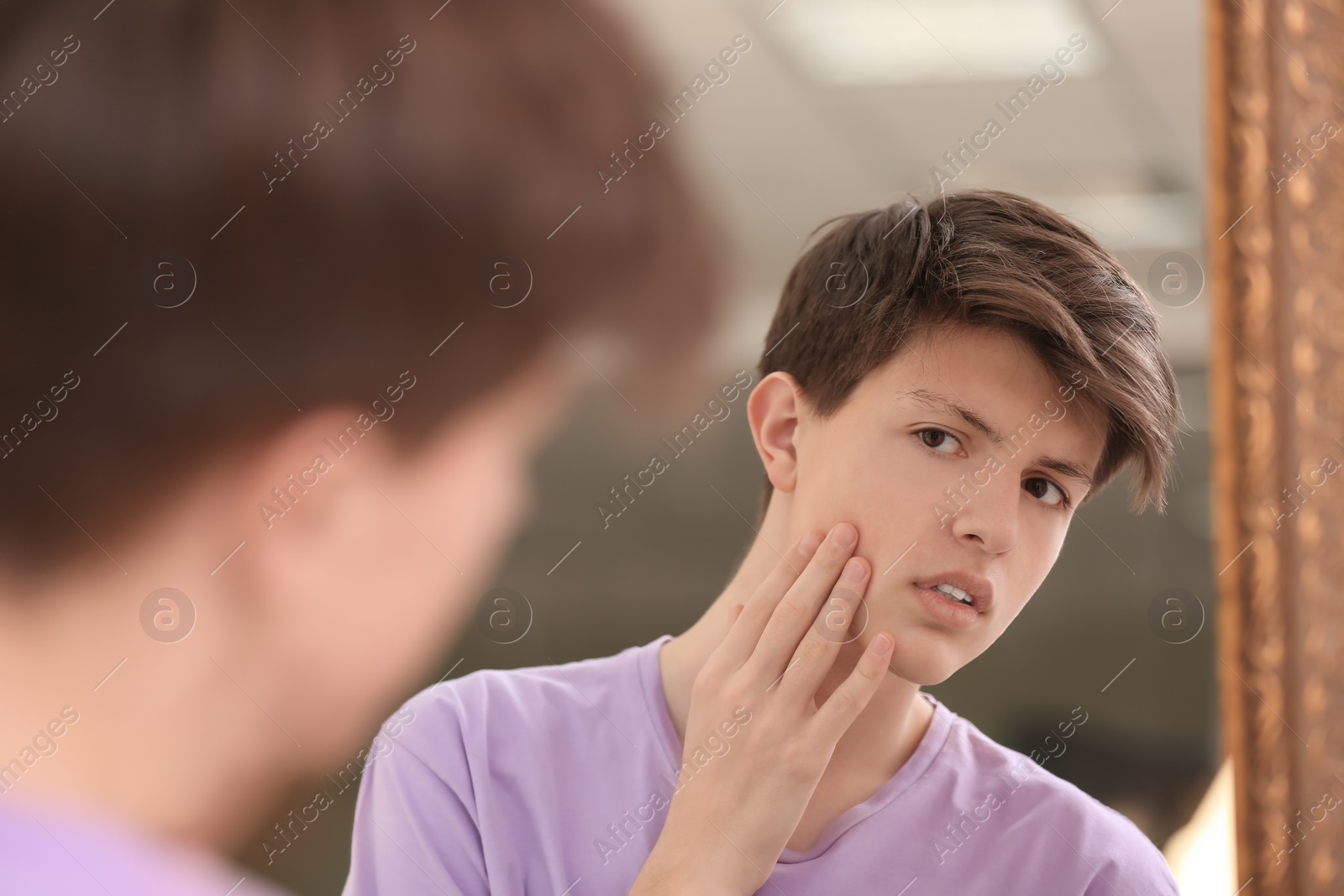 Photo of Teenage boy with acne problem looking in mirror at home