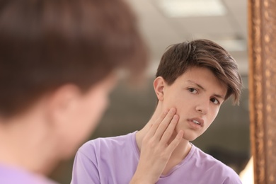 Photo of Teenage boy with acne problem looking in mirror at home