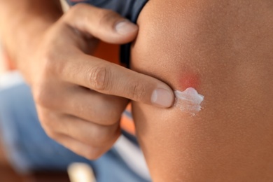 Photo of Man applying insect repellent cream on his arm outdoors, closeup