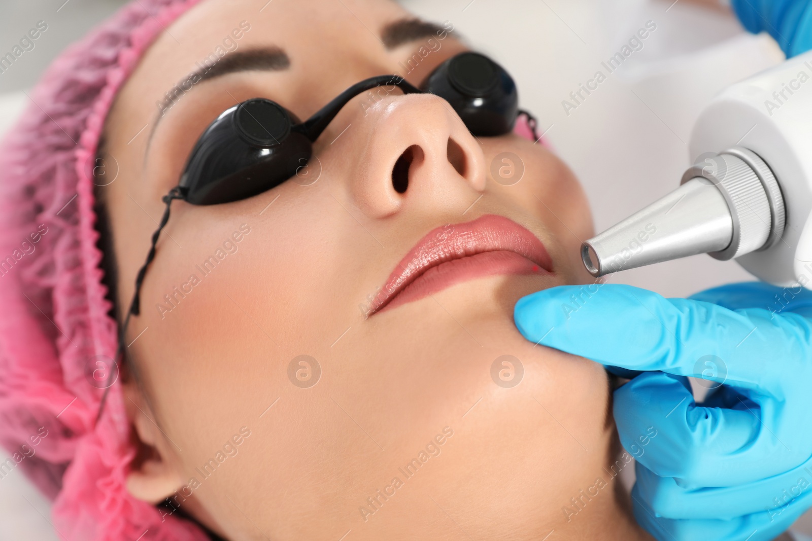 Photo of Woman undergoing laser tattoo removal procedure in salon, closeup