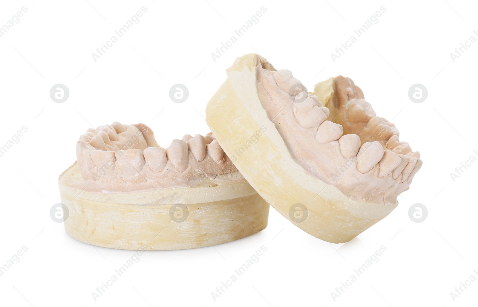 Photo of Dental model with jaws isolated on white. Cast of teeth