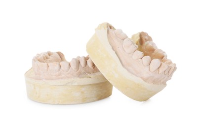 Photo of Dental model with jaws isolated on white. Cast of teeth