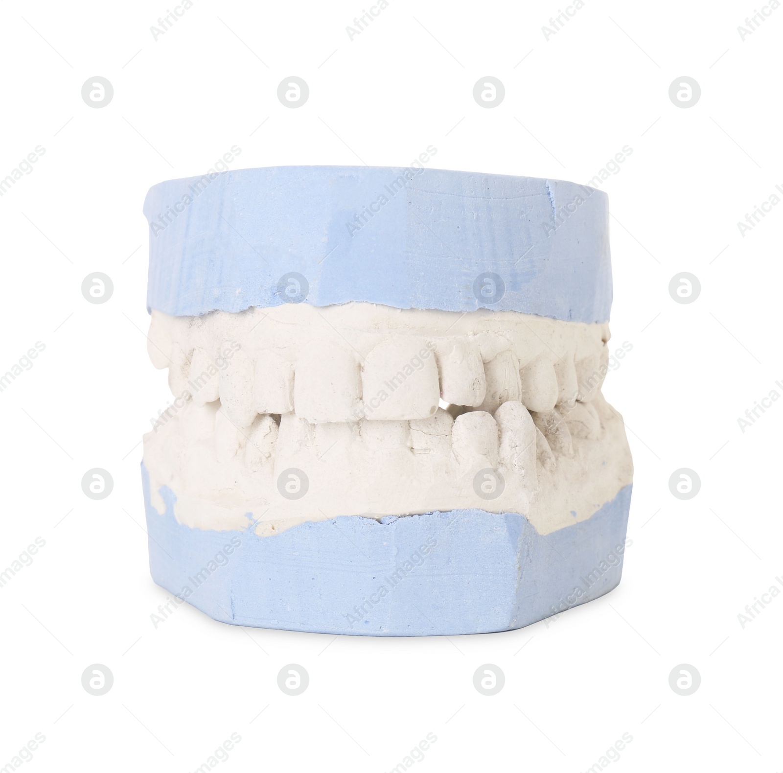 Photo of Dental model with gums isolated on white. Cast of teeth