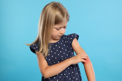 Photo of Suffering from allergy. Little girl scratching her arm on light blue background