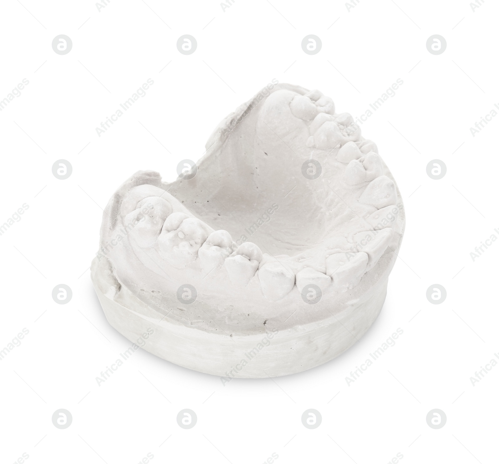 Photo of Dental model with jaw isolated on white. Cast of teeth