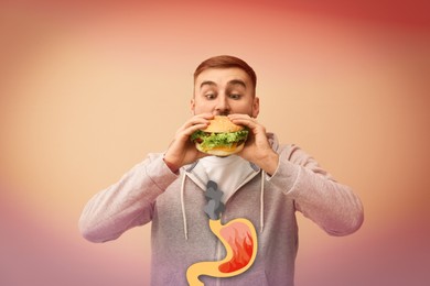 Improper nutrition can lead to heartburn or other gastrointestinal problems. Man eating burger on color background. Illustration of stomach with fire and smoke as acid indigestion