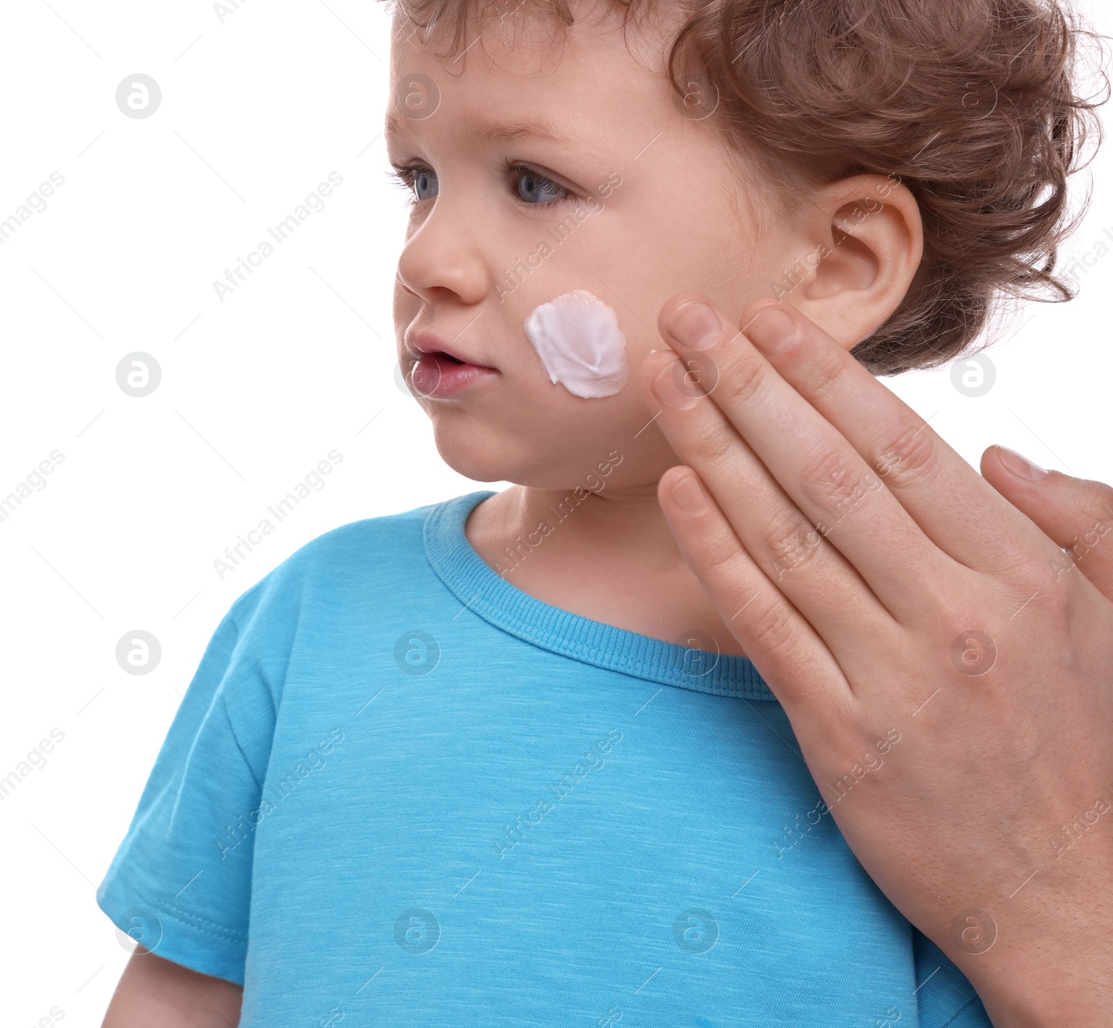 Photo of Father applying ointment onto his son`s cheek on white background, closeup