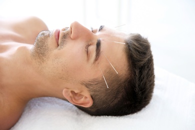 Photo of Young man undergoing acupuncture treatment in salon