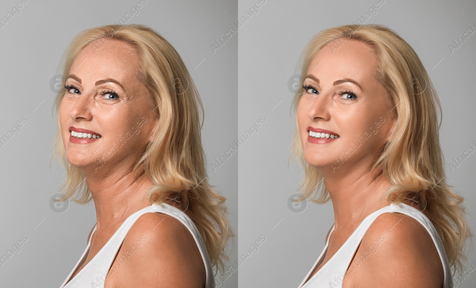 Image of Mature woman before and after cosmetic procedure on grey background 