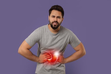 Man suffering from abdominal pain on purple background. Illustration of unhealthy stomach