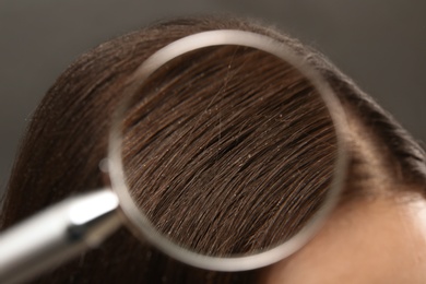 Closeup of woman with dandruff in her hair, view through magnifying glass