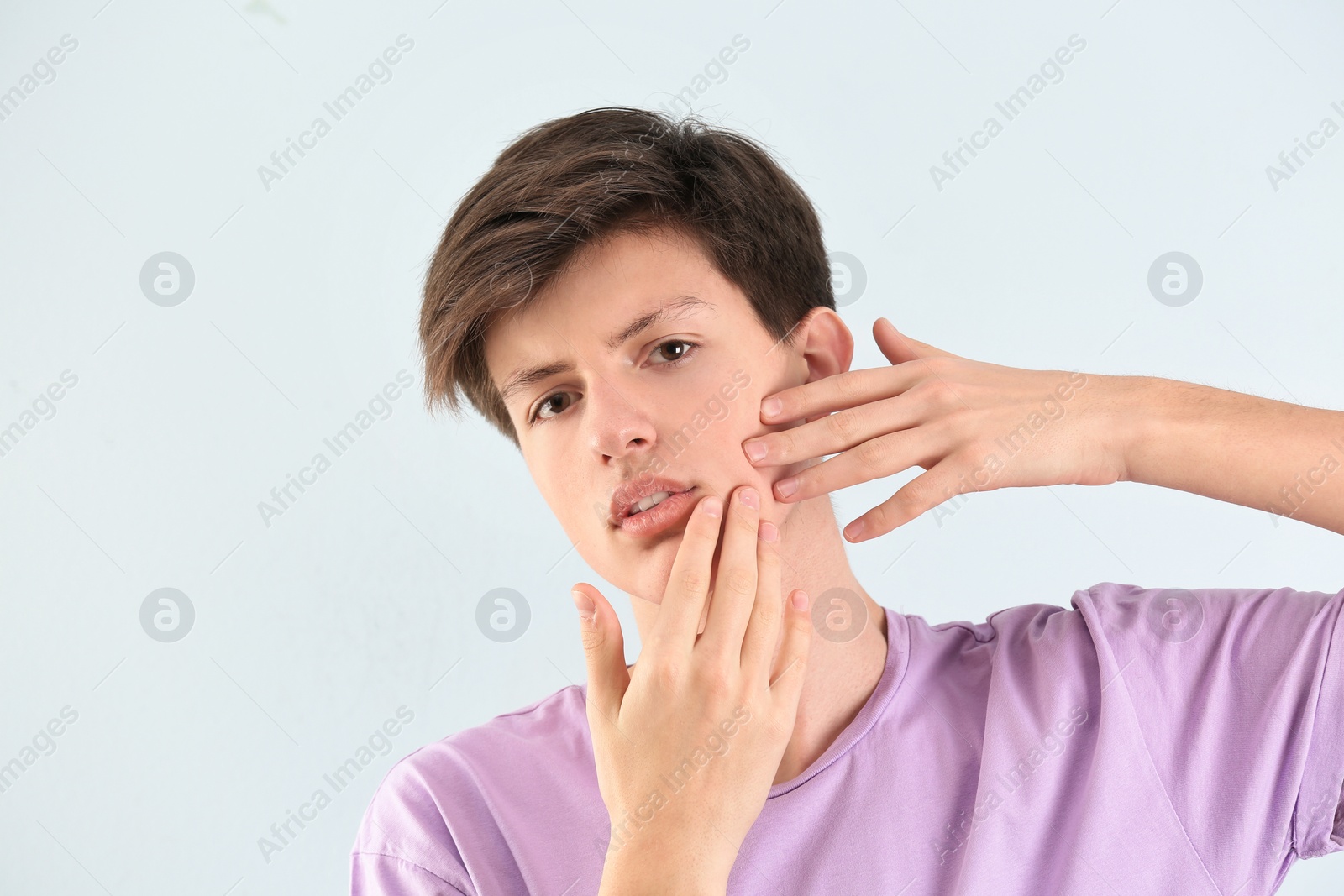 Photo of Teenage boy with acne problem on light background