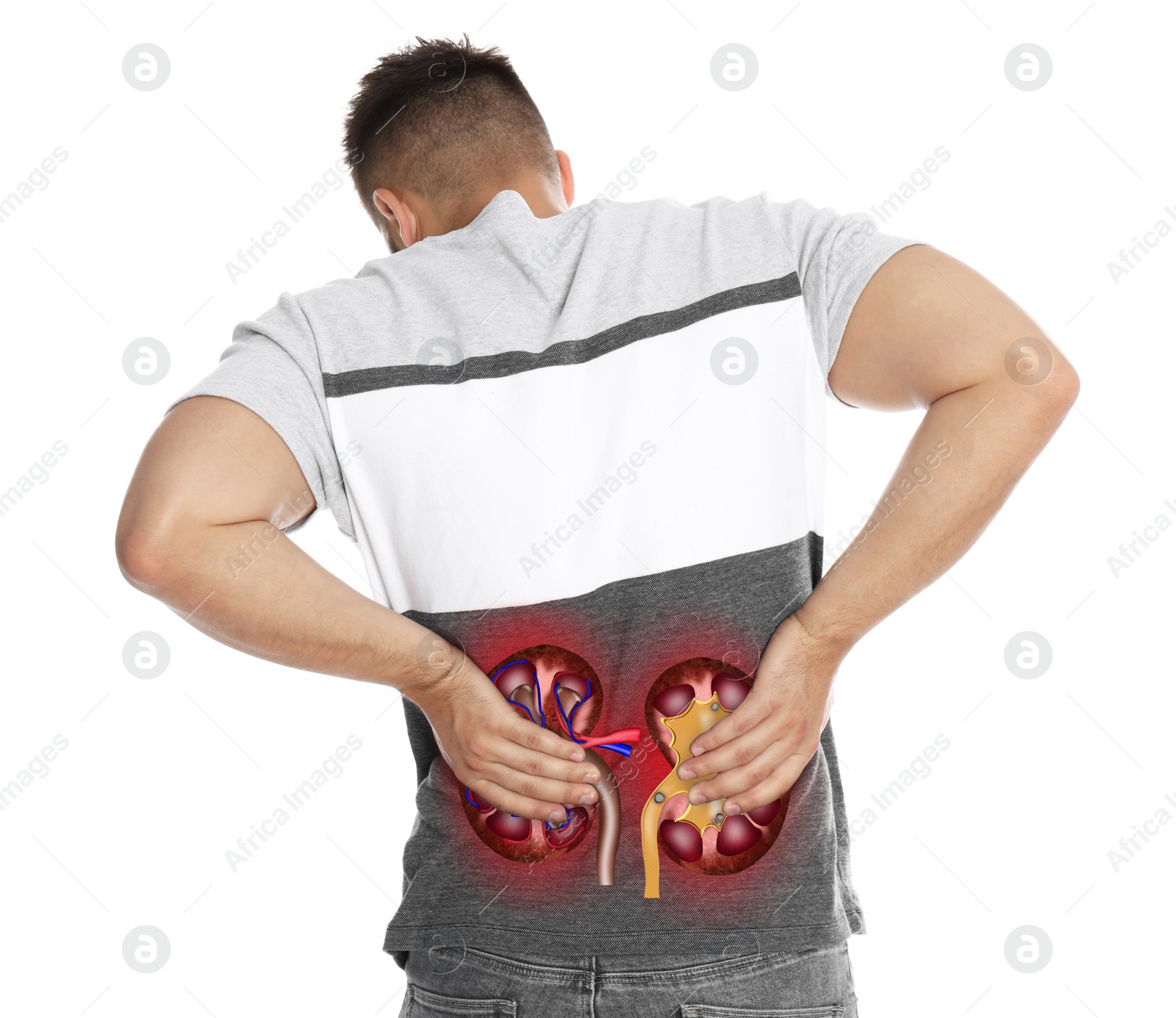 Image of Man suffering from kidney pain on white background