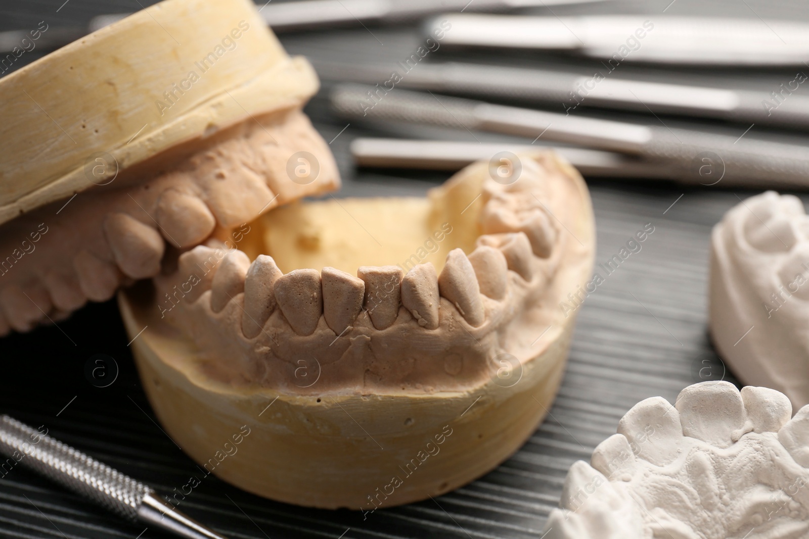 Photo of Dental models with gums and dentist tools on grey wooden table, closeup. Cast of teeth