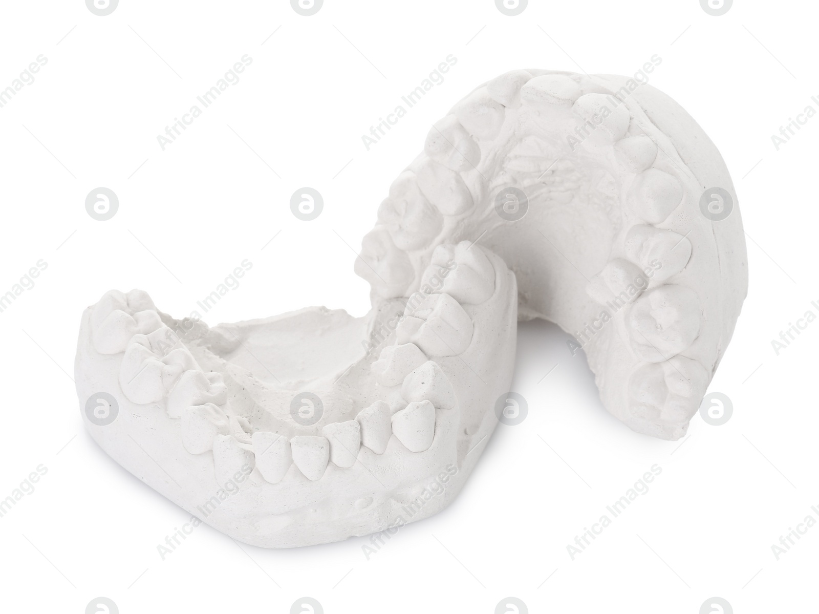 Photo of Dental model with gums isolated on white. Cast of teeth