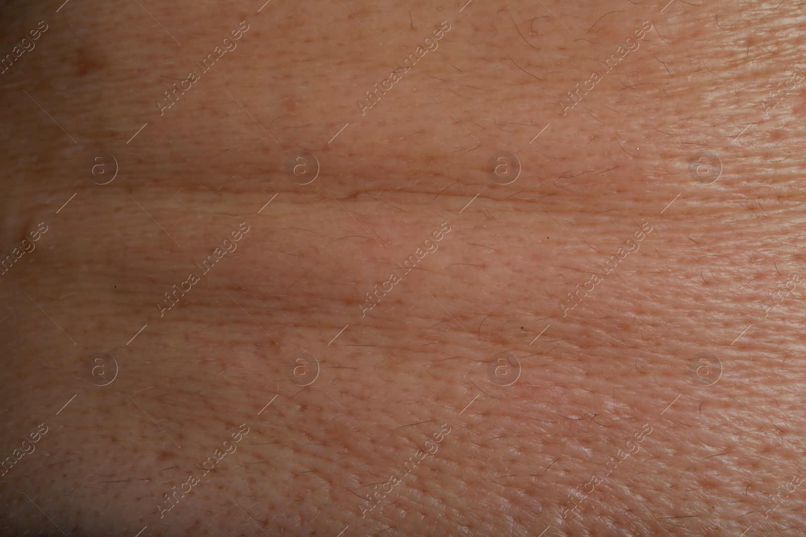 Photo of Closeup view of human skin as background