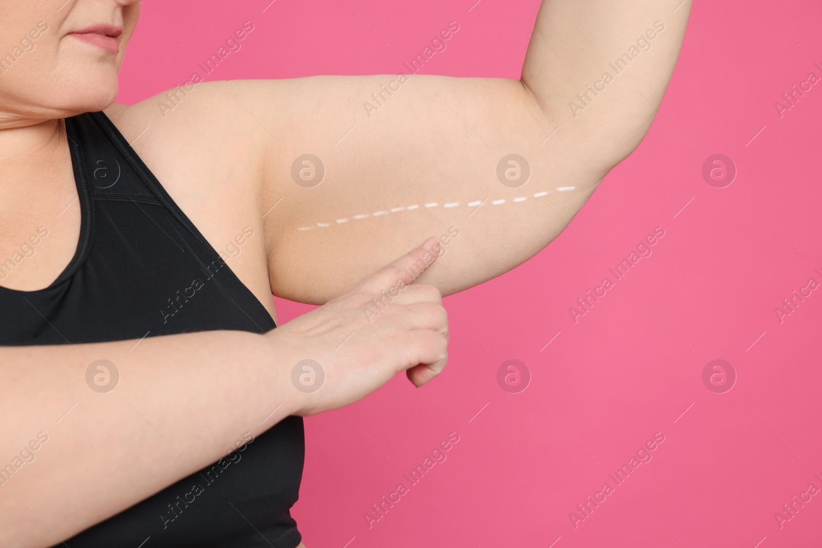 Photo of Obese woman with flabby arm on pink background, closeup. Weight loss surgery