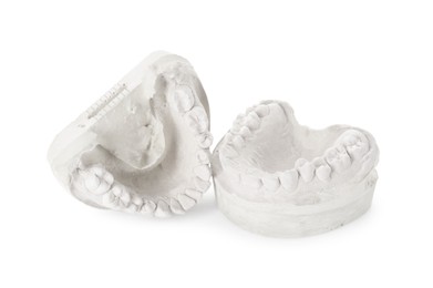 Photo of Dental model with jaws isolated on white. Cast of teeth