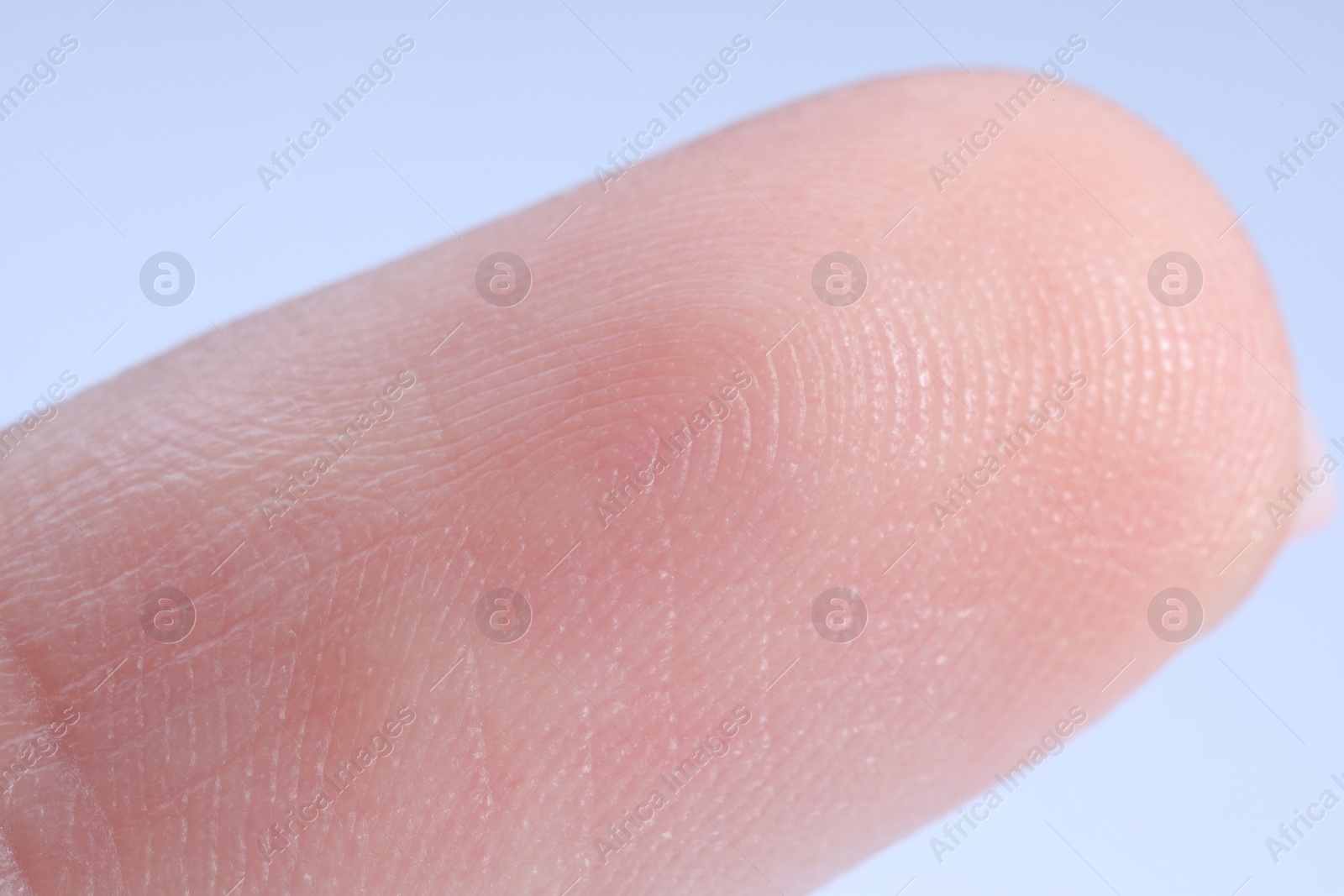 Photo of Finger with friction ridges on light blue background, macro view