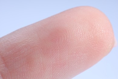 Photo of Finger with friction ridges on light blue background, macro view