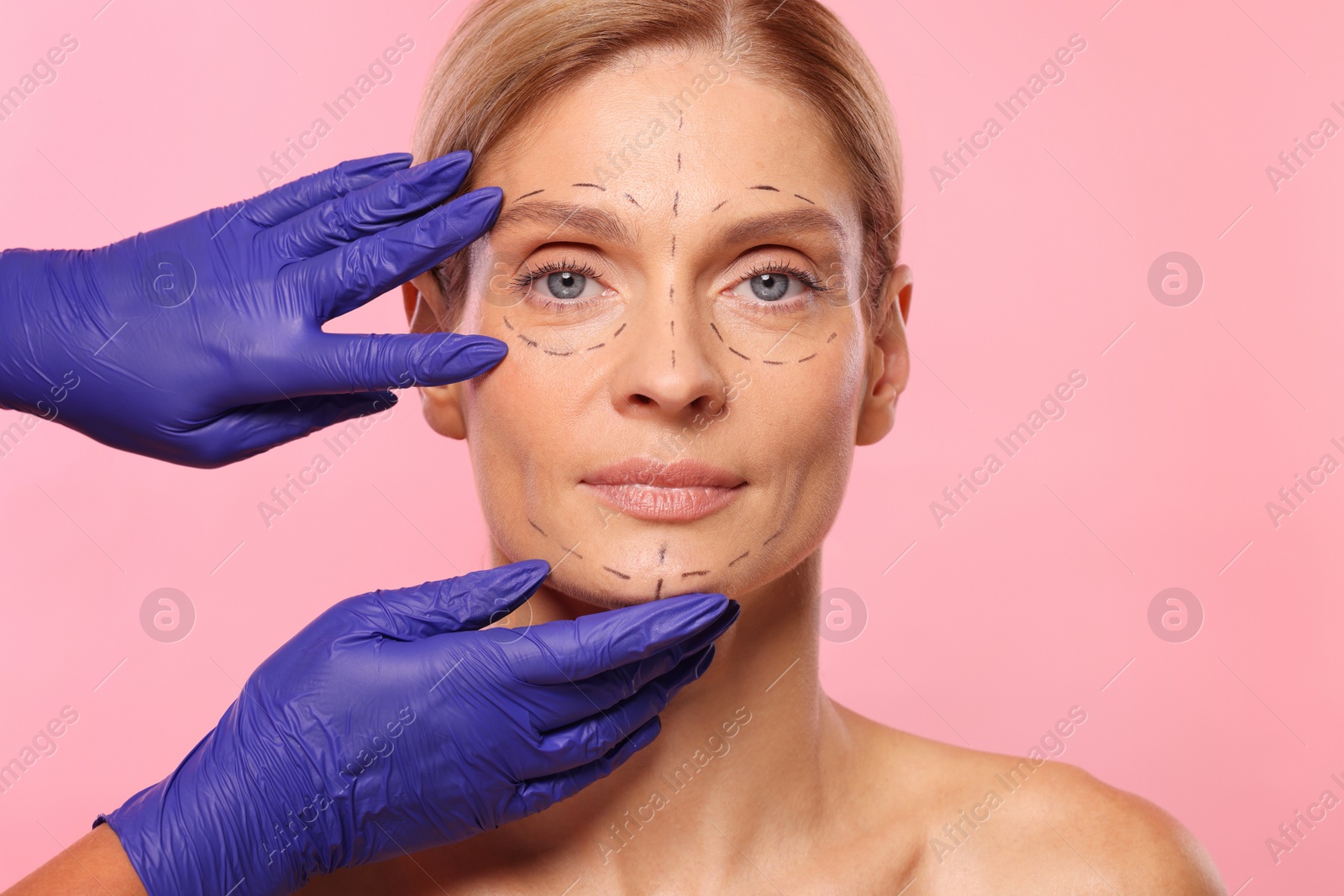 Photo of Doctor checking patient's face before cosmetic surgery operation on pink background, closeup