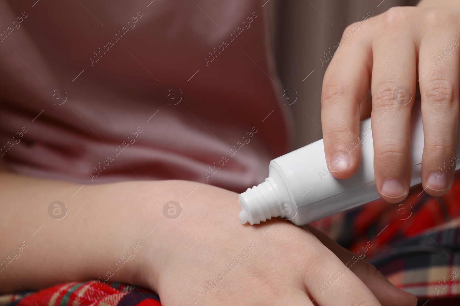 Photo of Little girl applying ointment onto her hand, closeup