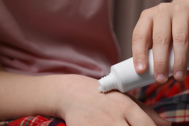 Little girl applying ointment onto her hand, closeup