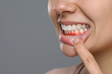 Woman showing inflamed gum on grey background, closeup. Space for text