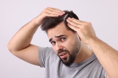 Photo of Emotional man with dandruff in his dark hair on light grey background