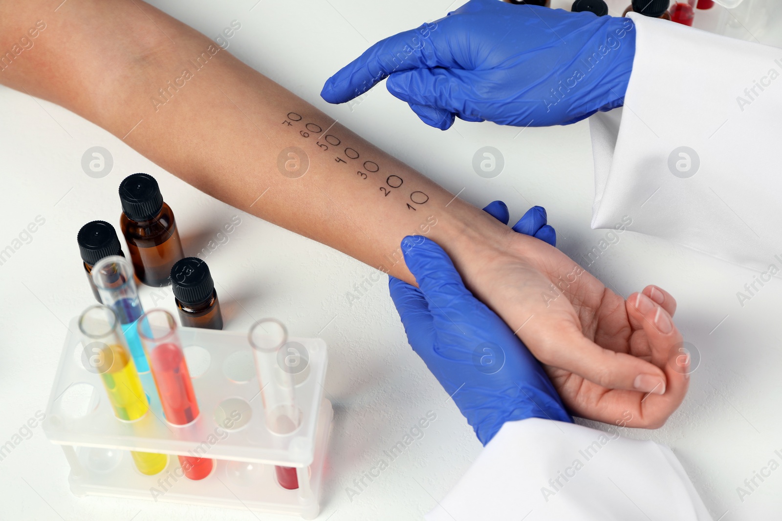 Photo of Doctor doing skin allergy test at light table, closeup