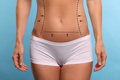 Image of Woman with markings for cosmetic surgery on her abdomen against light blue background, closeup