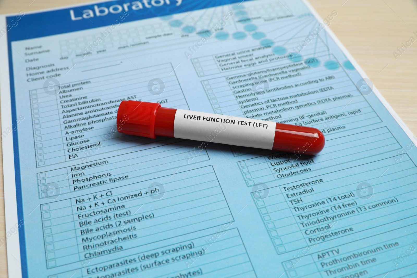 Photo of Liver Function Test. Tube with blood sample and laboratory form on table