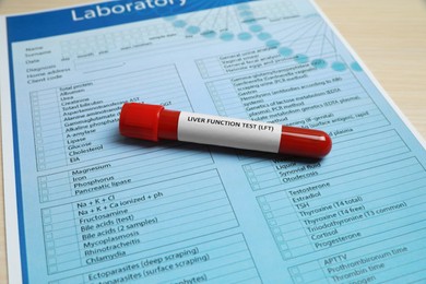 Photo of Liver Function Test. Tube with blood sample and laboratory form on table