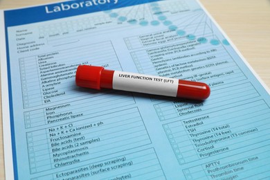 Liver Function Test. Tube with blood sample and laboratory form on table