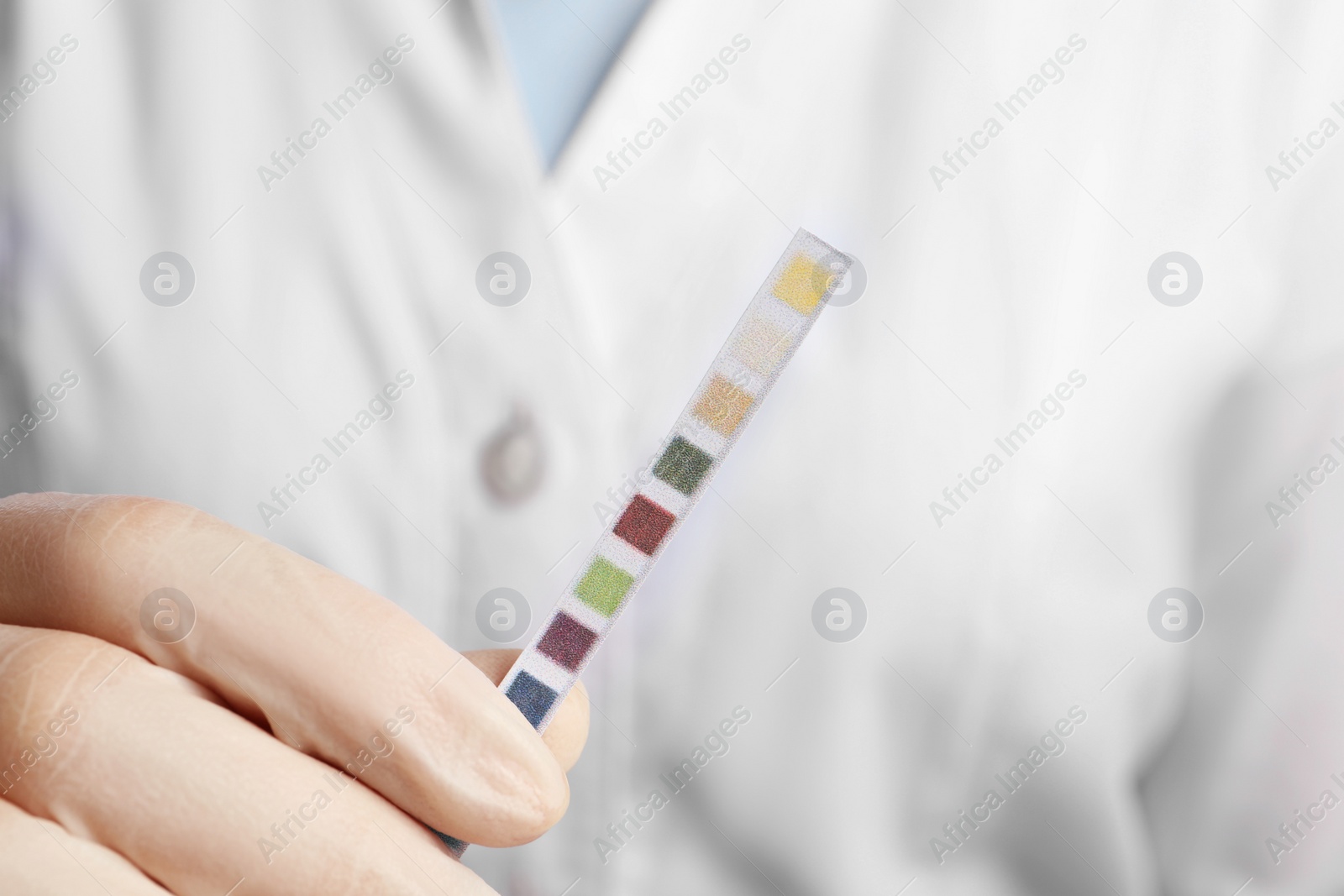 Photo of Doctor holding urine test strips, closeup view