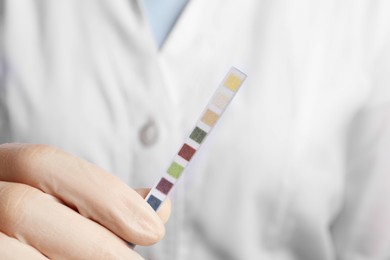Photo of Doctor holding urine test strips, closeup view