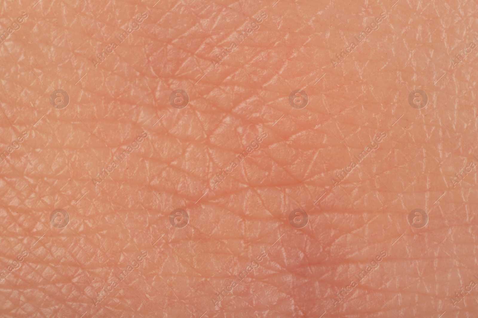 Photo of Texture of healthy skin as background, macro view