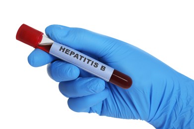 Scientist holding tube with blood sample and label Hepatitis B on white background, closeup