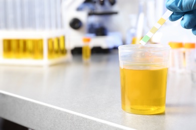 Laboratory assistant putting litmus paper into urine sample on table, closeup with space for text. Medical analysis