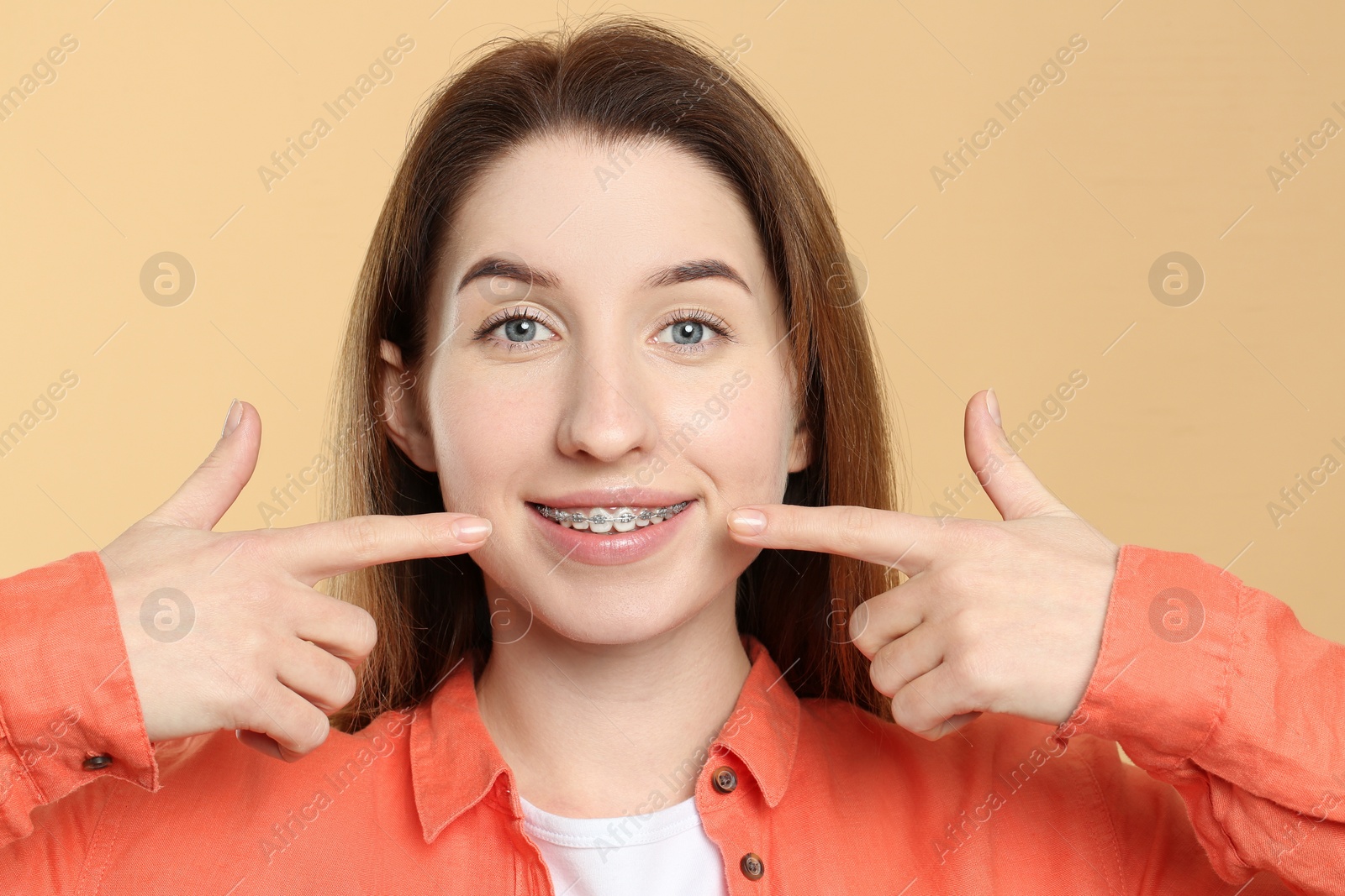 Photo of Portrait of smiling woman pointing at her dental braces on beige background