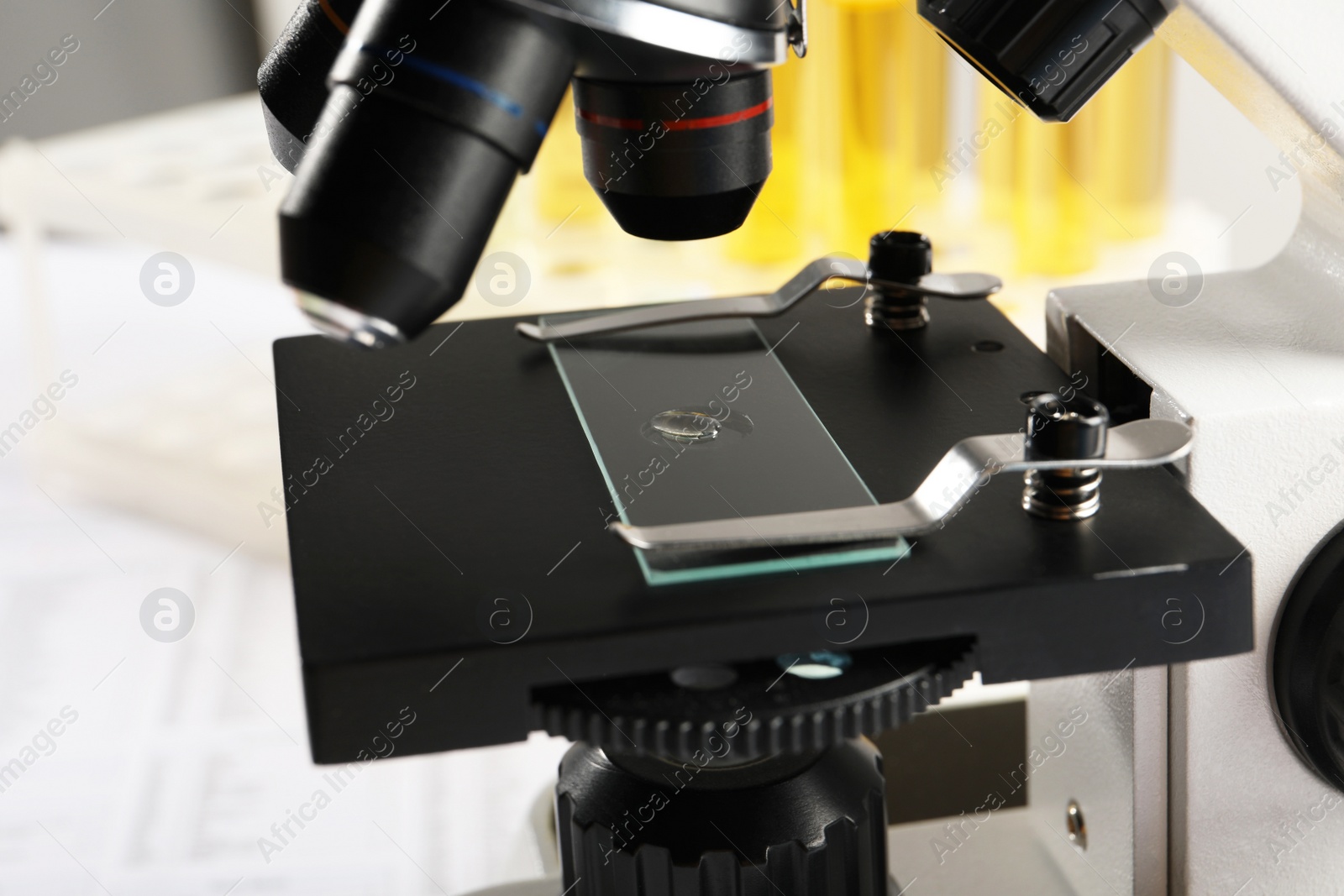 Photo of Microscope with drop of urine on glass slide in laboratory, closeup