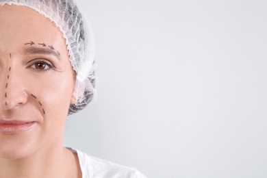 Mature woman with marks on face preparing for cosmetic surgery against white background, closeup. Space for text