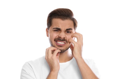 Photo of Young man scratching face on white background. Annoying itch