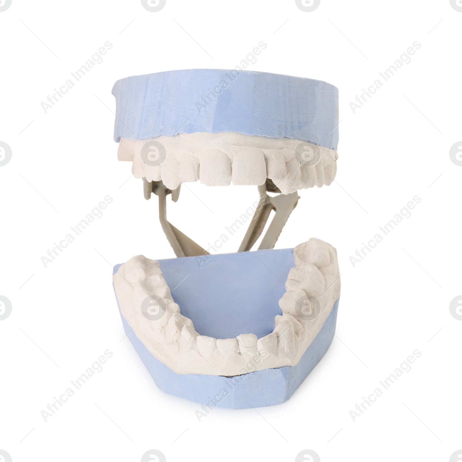 Photo of Dental model with gums isolated on white. Cast of teeth