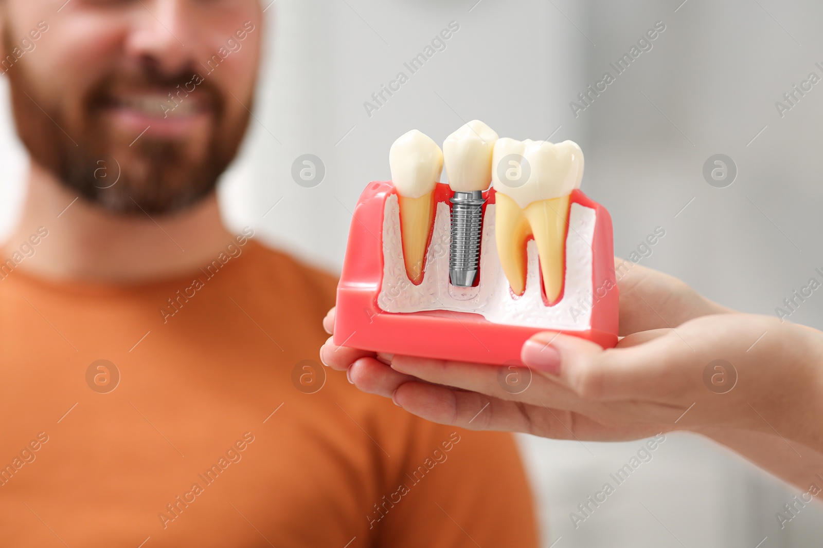 Photo of Doctor with educational model of dental implant consulting patient in clinic, closeup