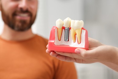 Doctor with educational model of dental implant consulting patient in clinic, closeup