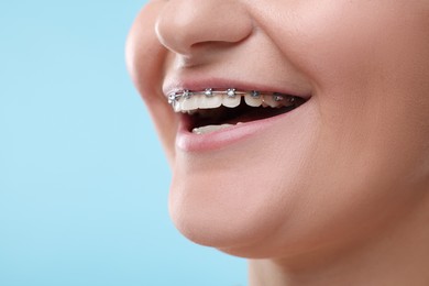 Photo of Smiling woman with dental braces on light blue background, closeup. Space for text