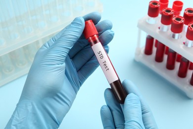 Photo of Scientist holding tube with blood sample and label STD Test on light blue background, closeup